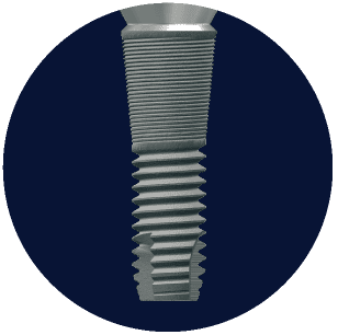 フィクスチャー