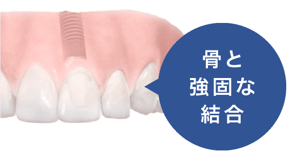 骨と強固な結合